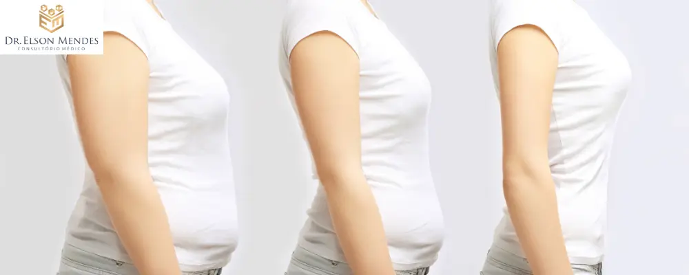 Emagrecimento Progresso Gradual